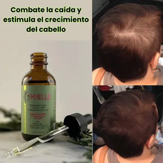 Aceite de romero| combate la caída y estimula el crecimiento del cabello