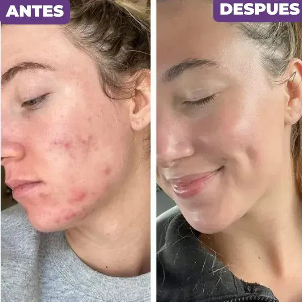 Naturaluxe™ - Crema en gel con cápsulas de vitamina C