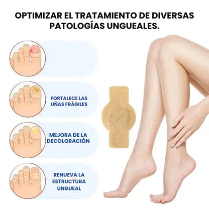 Parches de Tratamiento para uñas con hongos | 21 parches