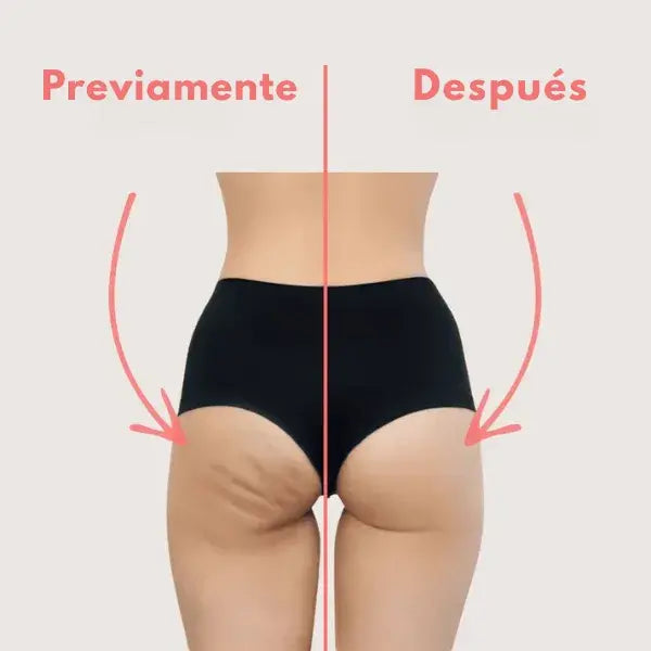 SkinStream Masajeador Anticelulítico | Piel visiblemente más suave en solo 4 semanas