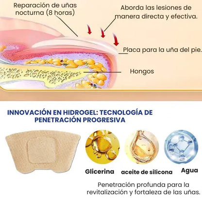 Parches de Tratamiento para uñas con hongos | 21 parches