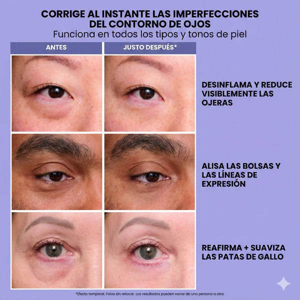 InfiniteLift - Gel tensor rejuvenecedor de ojos + 🎁 brocha gratis